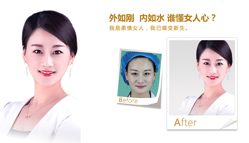 葫芦岛V脸、线雕隆鼻